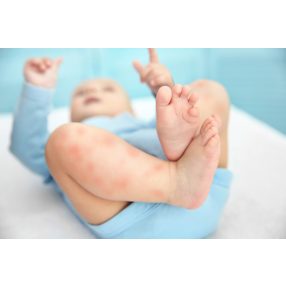 EKCÉMA ÁPOLÓ CSOMAG BABÁKNAK