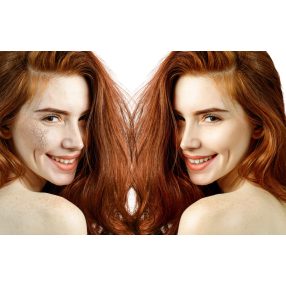 EXTRA SZÁRAZ BŐRÁPOLÓ CSOMAG ARCRA, TESTRE