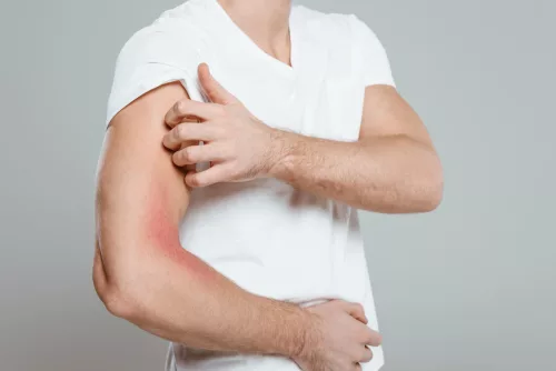 Dr. Hertelendy CARE Viszketés enyhítő hűsítő gél-pumpás NAGY