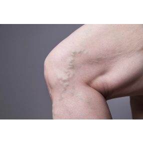 VISSZÉR, VÉNÁS KERINGÉS