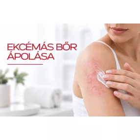 Ekcémás bőr ápolása