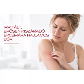 Irritált, erősen kiszáradó, ekcémára hajlamos bőr