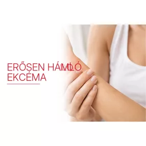 Erősen hámló ekcéma