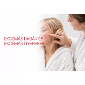 Ekcémás babák és ekcémás gyerekek