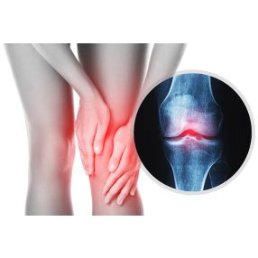 PORC, IZOM, CSONT EGÉSZSÉGE