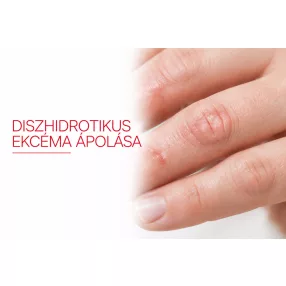 Diszhidrotikus ekcéma ápolása
