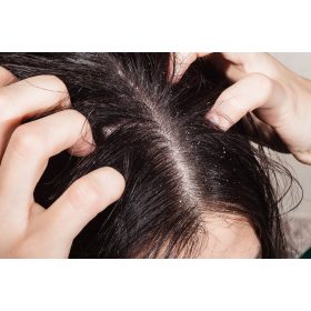 Korpás-szeborrheás fejbőr kezelése