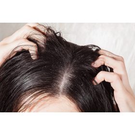 hogyan kezeljük a fejbőr pikkelysömörét a hajban