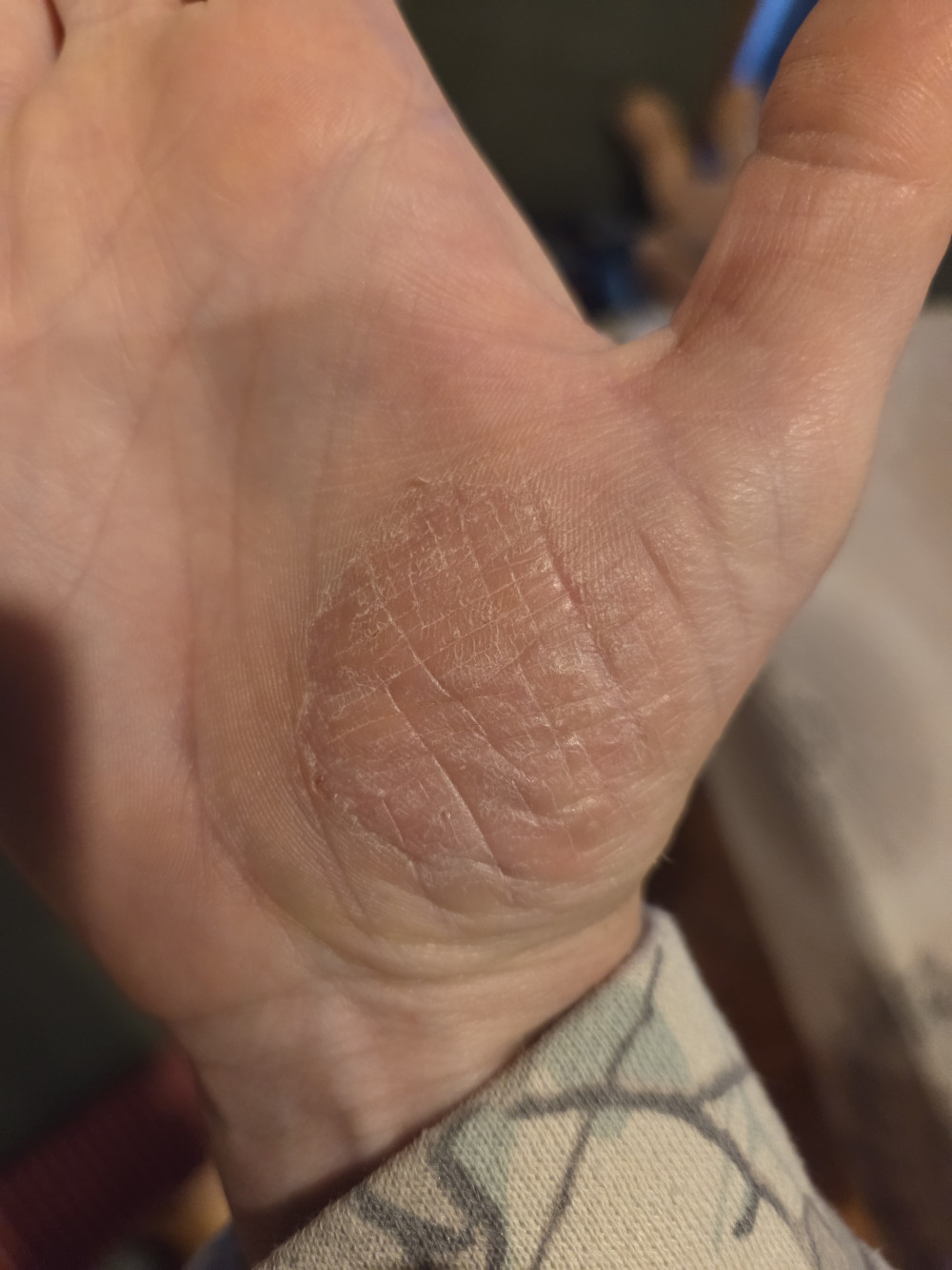 SEBES TENYÉREKCÉMA CSOMAG
